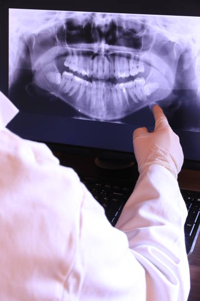Best Dentist for Tooth Abscess  in Presidio, TX