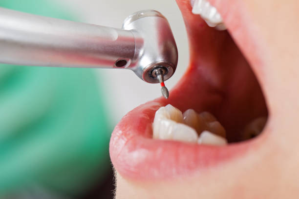 Best Urgent Tooth Repair  in Presidio, TX